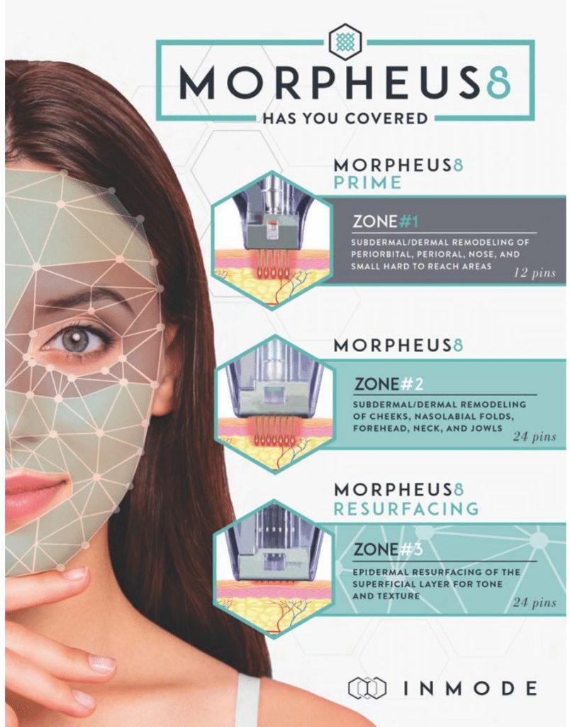 Morpheus 8 treatment at Lavish Wellness & Aesthetics