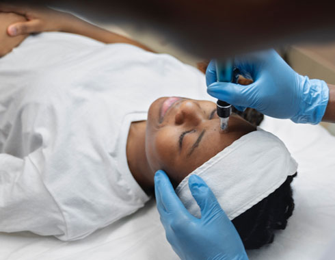 Microneedling Wilmington, Delaware