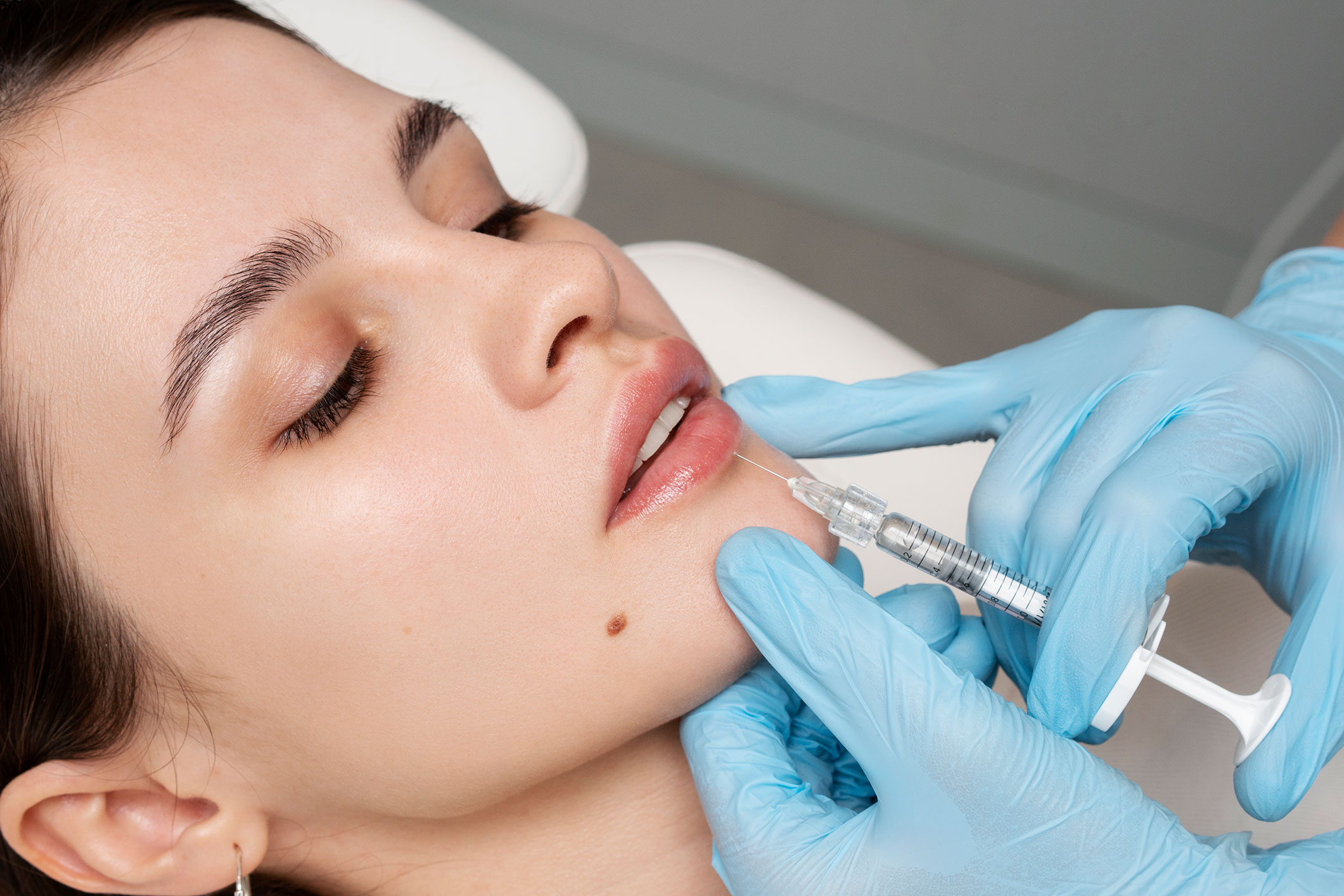 Botox Vs Dermal Fillers Lavish Wellness Blog 0474