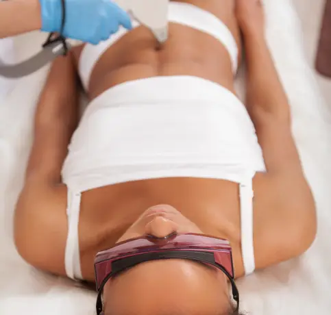 Laser Hair Removal dark skin in Wilmington