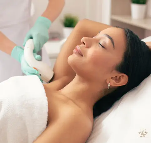 Laser Hair removal in Wilmington