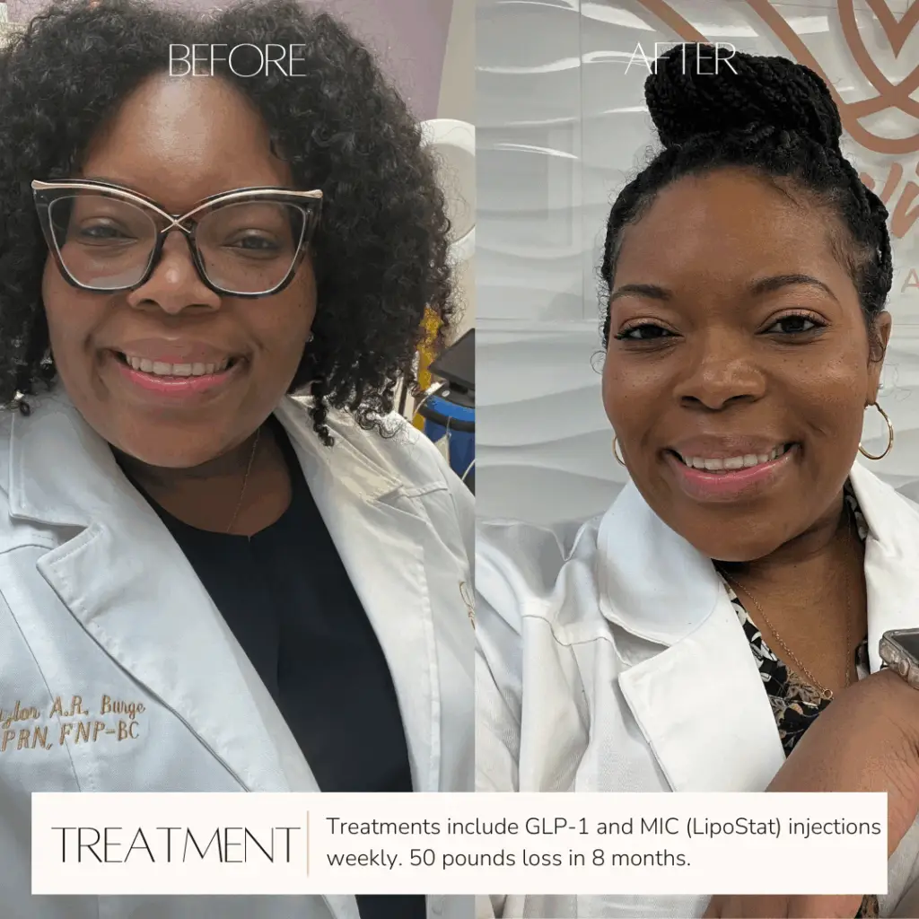 Before and After Images of Beautiful Women At Lavish