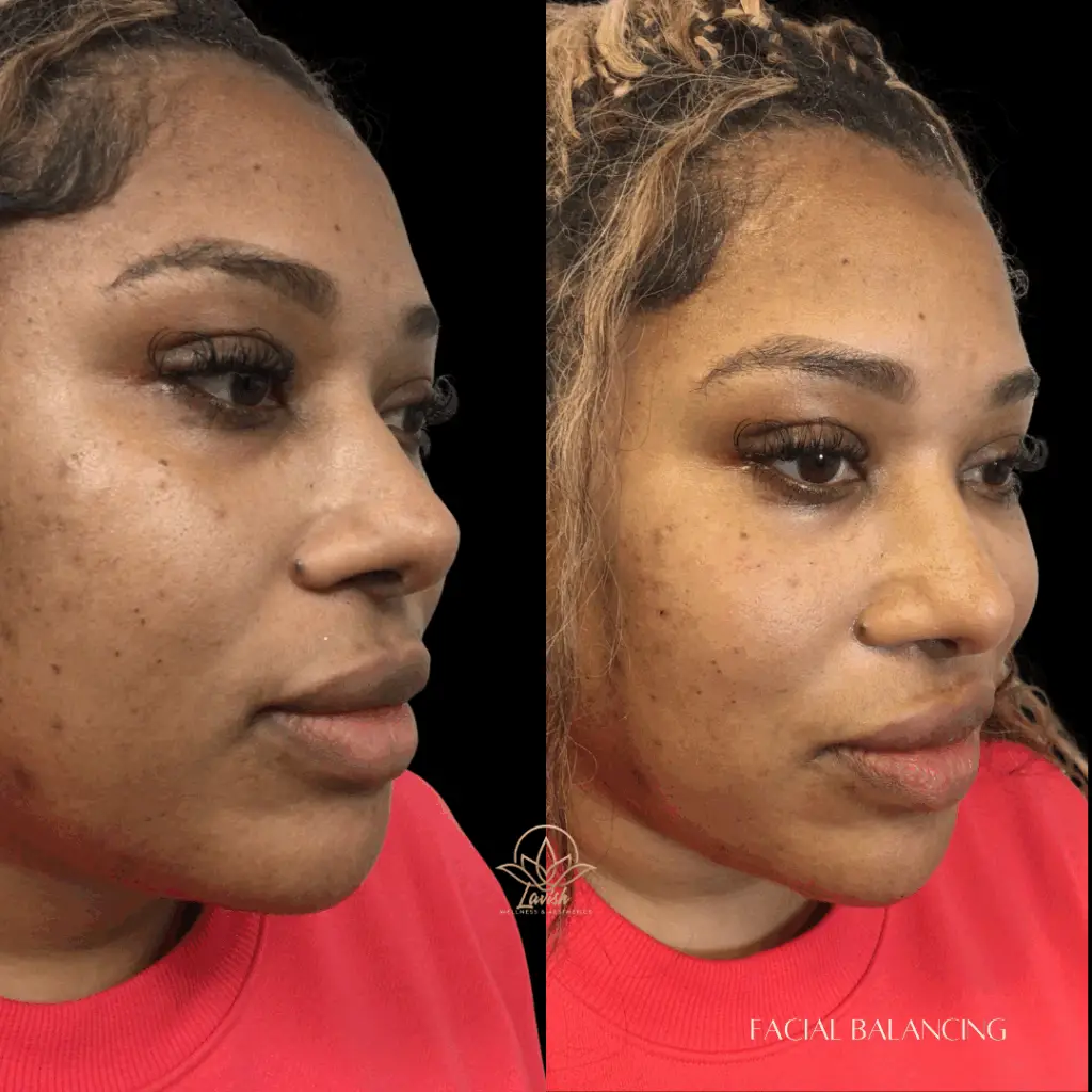 Facial Balancing Lavish (1)