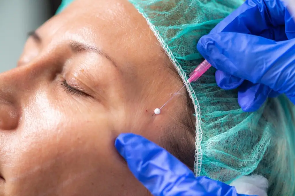 Top 7 Tips for Choosing the Best Botox Provider in Wilmington
