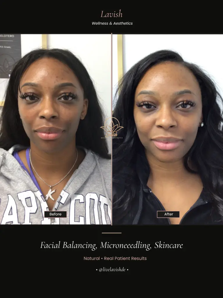 Facial Balancing In Wilmington DE (1)
