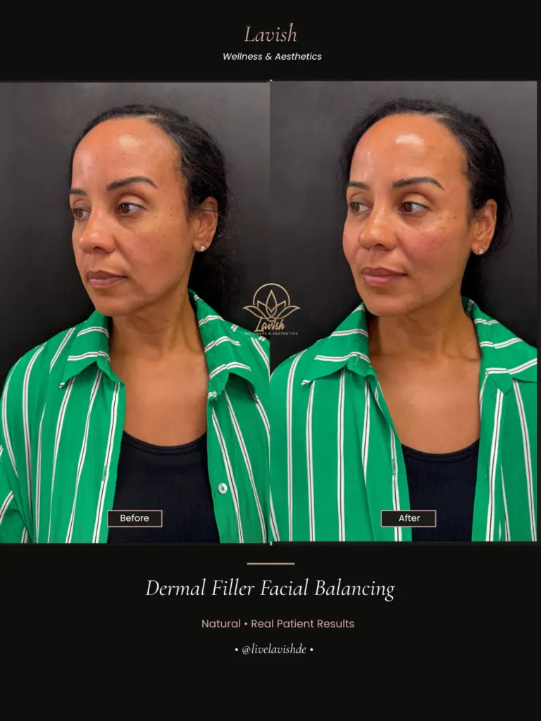 Facial Balancing In Wilmington DE (2)